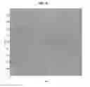Fig. 04 - Methods, immunoassays and devices for detection of anti-lipoidal antibodies
