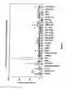 Fig. 04 - Multiplex screening for lysosomal storage disorders (LSDS)