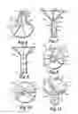 Fig. 03 - CUP-SHAPED BALLOON HOLDER WITH STICK