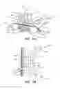 Fig. 02 - Putter heads and putters