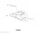 Fig. 04 - Endless belt arm exercise device with braking mechanism