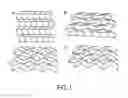 Fig. 02 - Apparatus for Forming a Sheet Structure from a Foldable Material