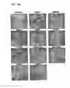 Fig. 09 - Variants of pigment epithelium derived factor and uses thereof