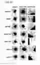 Fig. 11 - Variants of pigment epithelium derived factor and uses thereof