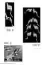 Fig. 04 - Enhancement of bone morphogenic protein (BMP) retention with BMP binding peptide (BBP)