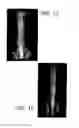 Fig. 11 - Enhancement of bone morphogenic protein (BMP) retention with BMP binding peptide (BBP)