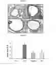 Fig. 05 - Pharmaceutical composition comprising an extract of pseudolysimachion longifolium and the catalpol derivatives isolated therefrom having antiinflammatory, antiallergic and antiasthmatic activity