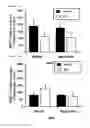 Fig. 22 - METHODS OF TREATING OR PREVENTING AN INFLAMMATORY DISEASE OR CONDITION USING GLUTAMINYL CYCLASE INHIBITORS