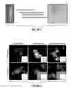 Fig. 14 - Molecular diagnostic methods for predicting brain metastasis of breast cancer