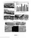 Fig. 07 - Use of MicroRNA for treating diseases associated with a dysfunction of the cilia in multiciliated epithelial cells