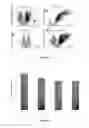 Fig. 09 - Use of MicroRNA for treating diseases associated with a dysfunction of the cilia in multiciliated epithelial cells