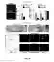 Fig. 12 - Use of MicroRNA for treating diseases associated with a dysfunction of the cilia in multiciliated epithelial cells