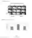 Fig. 06 - Method for treating inflammation by administering a compound which binds LDL-receptor-related protein (LRP) ligand binding domain