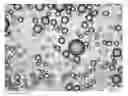 Fig. 01 - MULTIMODAL VISIBLE POLYMER EMBOLIZATION MATERIAL