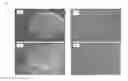 Fig. 04 - MULTIMODAL VISIBLE POLYMER EMBOLIZATION MATERIAL