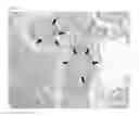 Fig. 09 - MULTIMODAL VISIBLE POLYMER EMBOLIZATION MATERIAL