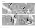 Fig. 10 - MULTIMODAL VISIBLE POLYMER EMBOLIZATION MATERIAL