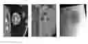 Fig. 16 - MULTIMODAL VISIBLE POLYMER EMBOLIZATION MATERIAL