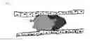 Fig. 20 - MULTIMODAL VISIBLE POLYMER EMBOLIZATION MATERIAL