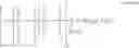 Fig. 07 - Method of making a contact lens