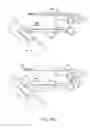 Fig. 12 - Devices and methods for tissue modification