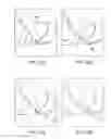 Fig. 17 - Devices and methods for tissue modification