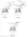 Fig. 40 - Devices and methods for tissue modification
