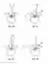 Fig. 42 - Devices and methods for tissue modification