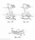 Fig. 74 - Devices and methods for tissue modification