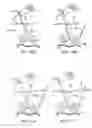 Fig. 84 - Devices and methods for tissue modification