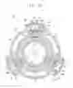 Fig. 11 - GUIDE ASSEMBLY FOR ENDOSCOPE