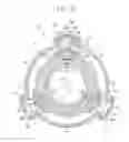 Fig. 10 - GUIDE ASSEMBLY FOR ENDOSCOPE