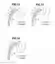 Fig. 08 - INSERTION AID AND ENDOSCOPE APPARATUS