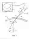 Fig. 02 - Endoscope
