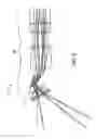Fig. 06 - Endoscope