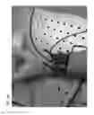 Fig. 07 - SYSTEMS, DEVICES AND METHODS FOR MONITORING HEMODYNAMICS