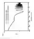 Fig. 12 - SYSTEMS, DEVICES AND METHODS FOR MONITORING HEMODYNAMICS