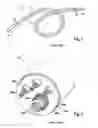 Fig. 02 - Implantable electrode lead