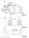 Fig. 08 - Implantable electrode lead