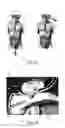Fig. 02 - Method, an optical probe and a confocal microscopy system for inspecting a solid organ
