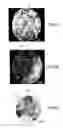 Fig. 09 - Method, an optical probe and a confocal microscopy system for inspecting a solid organ