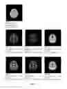 Fig. 03 - Method and apparatus for brain perfusion magnetic resonance images