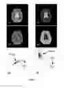 Fig. 04 - Method and apparatus for brain perfusion magnetic resonance images