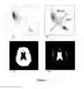 Fig. 05 - Method and apparatus for brain perfusion magnetic resonance images