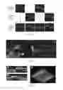 Fig. 10 - IMAGING AND VISUALIZATION SYSTEMS, INSTRUMENTS, AND METHODS USING OPTICAL COHERENCE TOMOGRAPHY