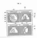 Fig. 05 - REFERENCE IMAGE DISPLAY METHOD FOR ULTRASONOGRAPHY AND ULTRASONIC DIAGNOSIS APPARATUS