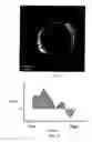 Fig. 03 - System and method for characterizing tissue based upon split spectrum analysis of backscattered ultrasound