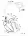 Fig. 09 - SYSTEMS AND METHODS FOR CORROBORATING IMPEDANCE-BASED LEFT ATRIAL PRESSURE (LAP) ESTIMATES FOR USE BY AN IMPLANTABLE MEDICAL DEVICE