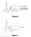 Fig. 07 - Diagnostic classifications of pulse signal waveform data