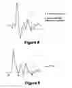 Fig. 08 - Diagnostic classifications of pulse signal waveform data